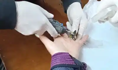 El anillo no salía y creció la desesperación: terminó en el cuartel de Bomberos de Rawson