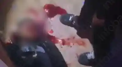 Un joven terminó en el hospital tras un violento episodio en un boliche: la versión oficial y la denuncia familiar chocan de frente