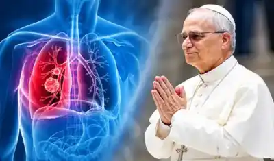 El neumonólogo tucumano que explicó el tumor del papa León XIV: en qué casos la cirugía puede curar el cáncer