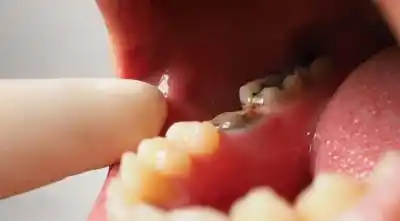 El error que muchos cometen al cepillarse los dientes después de comer