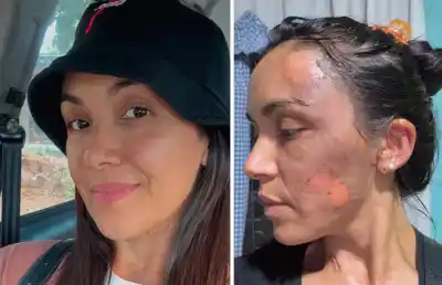 Agresión con agua hirviendo en un club: las tres mujeres que hoy enfrentan la justicia