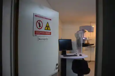 La mamografía que se hacían todas tenía un atajo: desde hoy no hace falta la orden médica