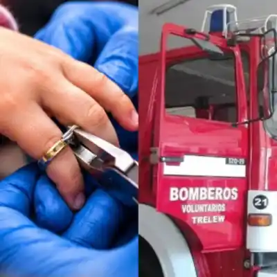 Un anillo no salía de su dedo y la nena de 4 años terminó en manos de los bomberos