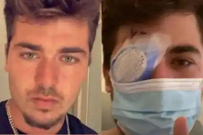 Durmió 40 minutos con los lentes puestos y despertó sin poder ver: "Los parásitos se comieron mi ojo"