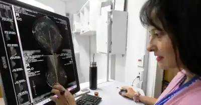 Mamografías gratis en Río Negro: el requisito que ya no hay que cumplir para hacérselas