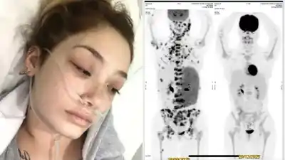 Una joven de 22 años pelea contra el cáncer y lo que le hicieron con su cobertura médica es indignante