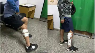 Le ordenó que frene, no lo hizo y le disparó a quemarropa: dos hermanos heridos en Alto Verde