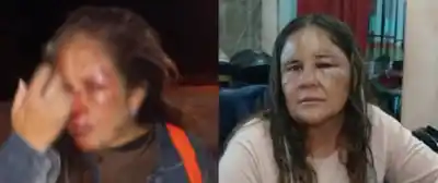 Golpearon y desfiguraron a dos vecinas en Calingasta: la Justicia tomó una decisión que las dejó en libertad