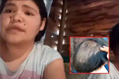 Su hijo de 8 años se quedó sin pelo y ella sale a juntar $60.000 por mes: la historia que conmueve a Concordia
