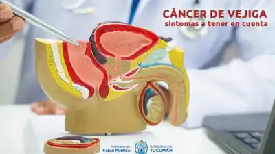 Sangre en la orina: el síntoma que muchos ignoran y que un urólogo de Tucumán pide no dejar pasar