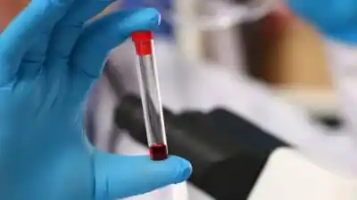 Descubren en Argentina un tipo de sangre tan raro que solo seis personas lo tienen en todo el país