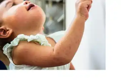 Su hija tuvo sarampión a los 5 meses. Diez años después, el virus la mató de una forma que los padres deben conocer