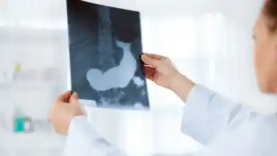 Analizaron tomografías de páncreas con inteligencia artificial y lo que descubrieron dejó helada a la ciencia