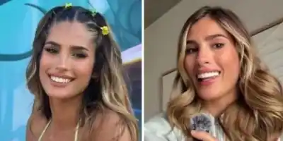 Julieta Poggio se sacó las carillas y mostró cómo quedaron sus dientes: “Me afectó”