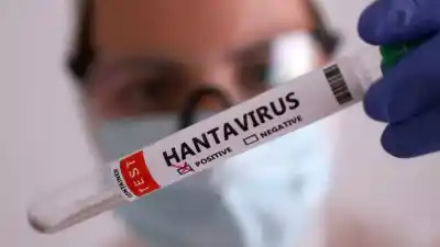 Lo que la OMS no quiere que sepas sobre el hantavirus: un brote en un crucero que lo cambió todo