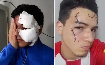 Lo atacaron a cuchilladas para robarle el celular y el detalle de los agresores indignó a los vecinos