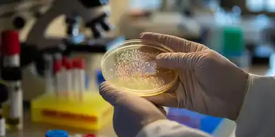 La alarma que encienden las superbacterias: ya no están solo en los hospitales