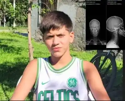 Intentó separar una pelea en un partido de fútbol y terminó con una doble fractura de mandíbula