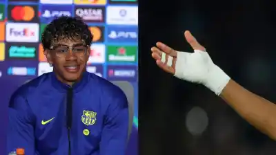 El insólito motivo por el que Lamine Yamal juega con la mano vendada