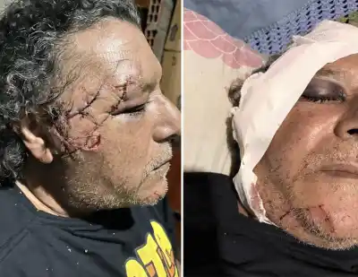 A las 6.30, padre e hijo iban a trabajar en bici: los atacaron a cuchillazos y uno sigue en terapia
