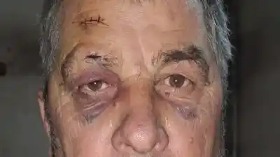 Giró la cabeza pensando que era una broma y una bala le rozó la ceja: la increíble historia del remisero de Chivilcoy