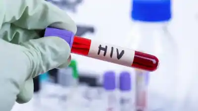 La cifra que preocupa a los especialistas: 1 de cada 2 diagnósticos de VIH llega tarde en Argentina