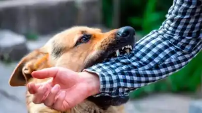 Un jubilado de 65 años terminó en el hospital tras ser atacado por su propio perro en el barrio Parque