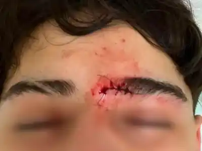 El relato que estremece: así comenzó la salvaje golpiza a juveniles de Bella Vista en Punta Alta