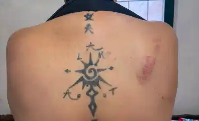 Madre denuncia violencia policial en Tafí Viejo: fractura y gas pimienta en pleno festejo mundialista