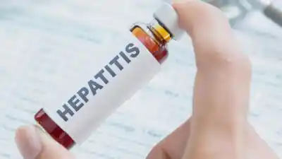 ¿Naciste antes del 2000? Podrías tener hepatitis sin saberlo y esto es lo que tenés que hacer