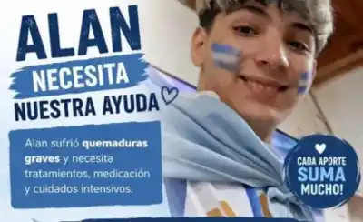 Incendio en barrio San Martín: la lucha de Alan, el adolescente de 14 años que necesita viajar a Buenos Aires para recuperarse