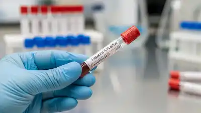 San Juan libre de hepatitis A: dos años sin casos, pero las variantes B y C preocupan con 75 diagnósticos anuales