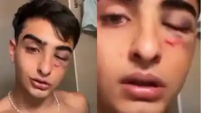 Patricio Ledezma, el joven atacado en Tafí del Valle, denunció a los rugbiers: “Pueden matar a alguien”