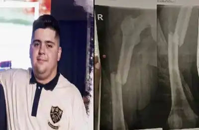 Un conductor ebrio lo dejó al borde de perder una pierna: la desesperada carrera de su familia para salvarlo