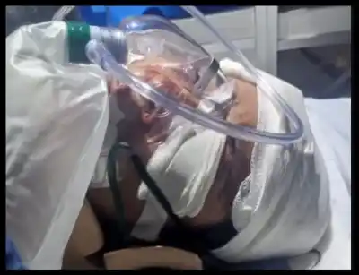 Sobrevivió a un ataque brutal: la dieron por muerta y ahora recibió el alta