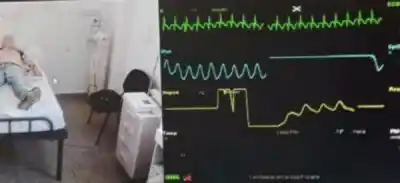 Concepción: el minuto a minuto que salvó la vida de un hombre de 48 años tras un infarto
