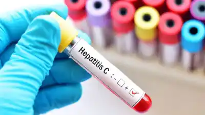 Llegan a Rosario los testeos gratuitos de hepatitis que pueden salvar vidas: dónde y cuándo