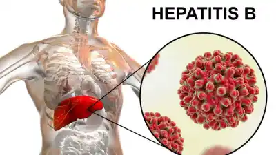 Día Mundial contra la Hepatitis: la vacunación, la única barrera contra una enfermedad silenciosa