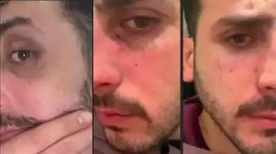Un mensaje que estremece: “¿Otra vez te pegó?” y las fotos que sepultan el silencio de Matías