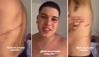 Las cicatrices que Thiago Medina no puede esconder: el crudo relato tras el accidente que lo dejó al borde de la muerte