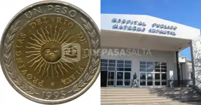 Una nena de 4 años se tragó una moneda en Metán y debieron operarla en el Materno