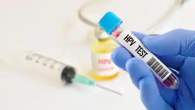 Sin obra social y mayores de 30: la oportunidad que San Juan ofrece para detectar el HPV a tiempo