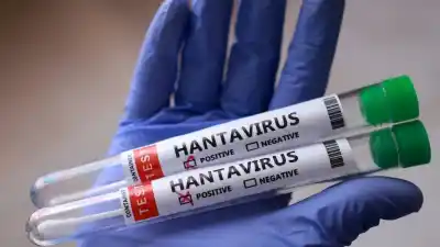 Un argentino con hantavirus en España: por qué lo aislaron con su familia y qué se sabe
