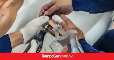 Un simple anillo se convirtió en una urgencia: bomberos tuvieron que usar un minitorno