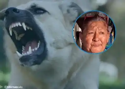 La atacó un perro en Campo Quijano, quedó con una herida infectada y la dueña no aparece