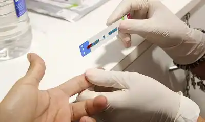 Alerta en Salta: crecen los casos de sífilis y refuerzan la prevención