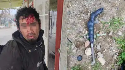 Atacó con un fierro a dos hombres en Centenario y los vecinos estallaron: “¿Hasta cuándo?”