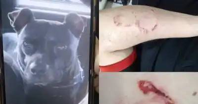 Fue a un lavadero de autos en Tolosa y un pitbull lo atacó: terminó hospitalizado