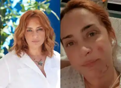 Las cicatrices que María Julia Oliván decidió mostrar: el crudo mensaje que dejó tras un accidente devastador