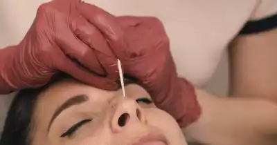 Quería resaltar sus pecas y terminó con marcas en la cara: la denuncia que estalló en redes